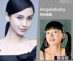 西安整容爆料案件最新情况,真相逐步浮出水面